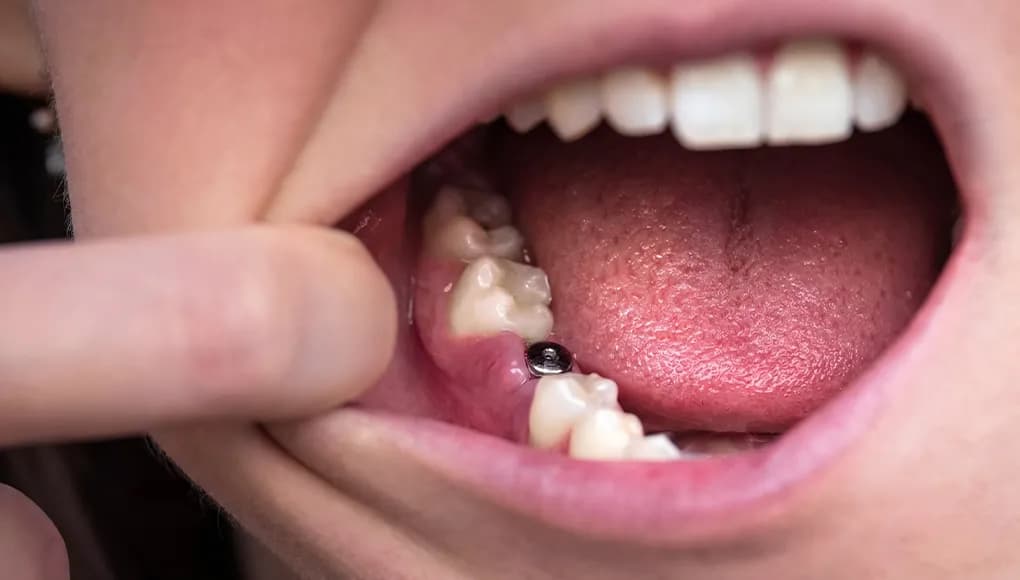 Modern dental operatory with CT scanner at Willow Family Dentistry