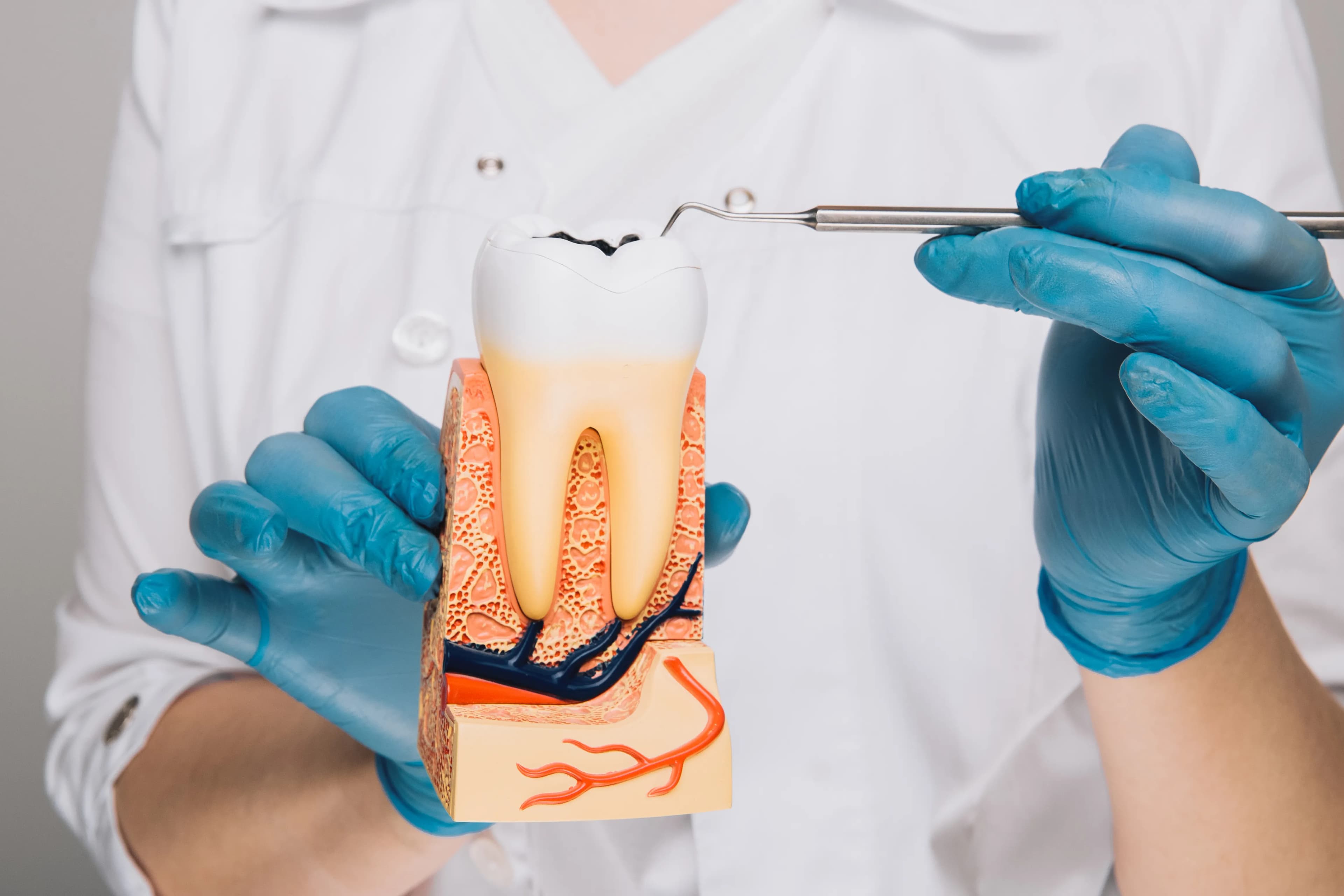 Dental Crowns